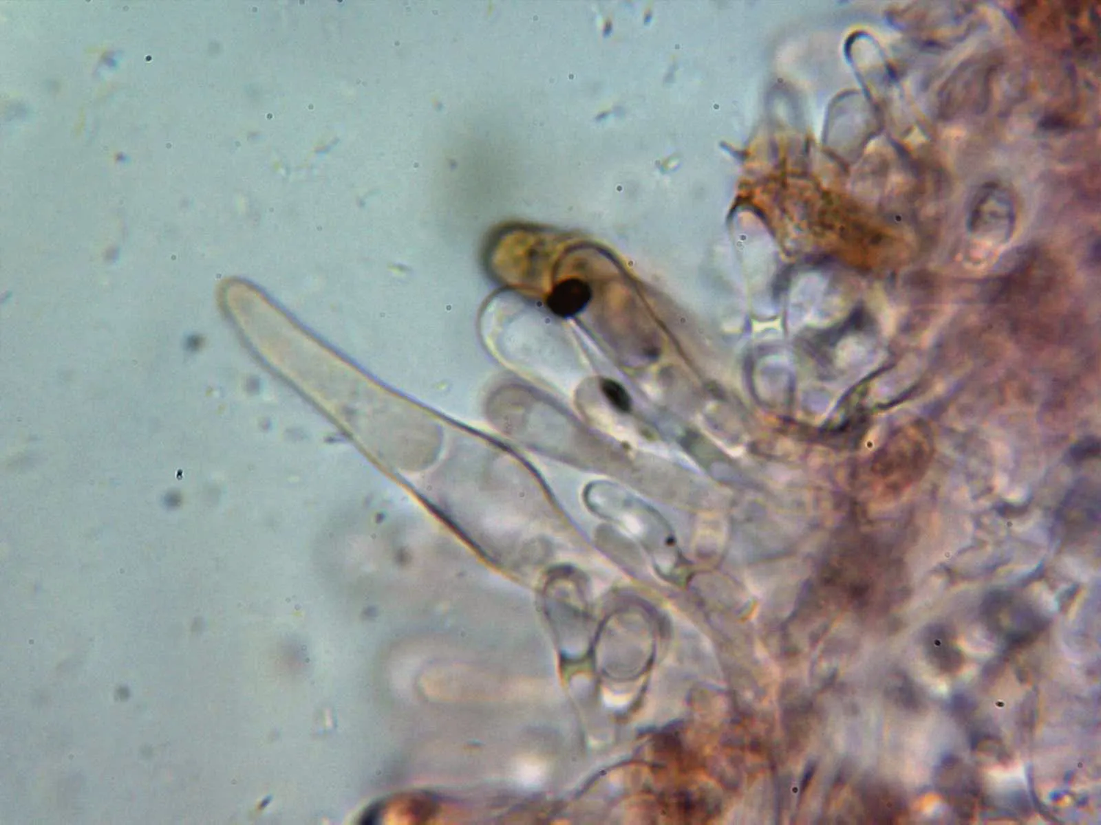 Microscopía de Rheubarbariboletus armeniacus - 10 - Queilocistidios 3